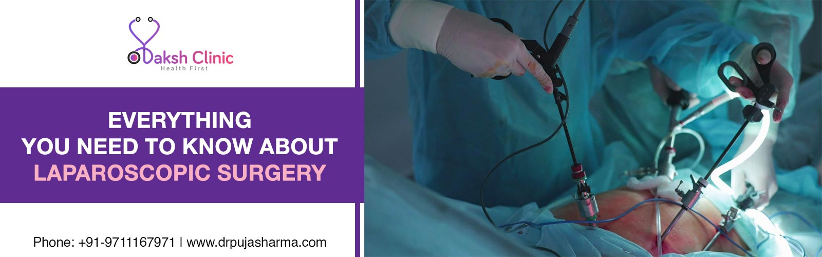 laparoscopic surgery in delhi